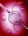 Image showing intracytoplasmic sperm injection